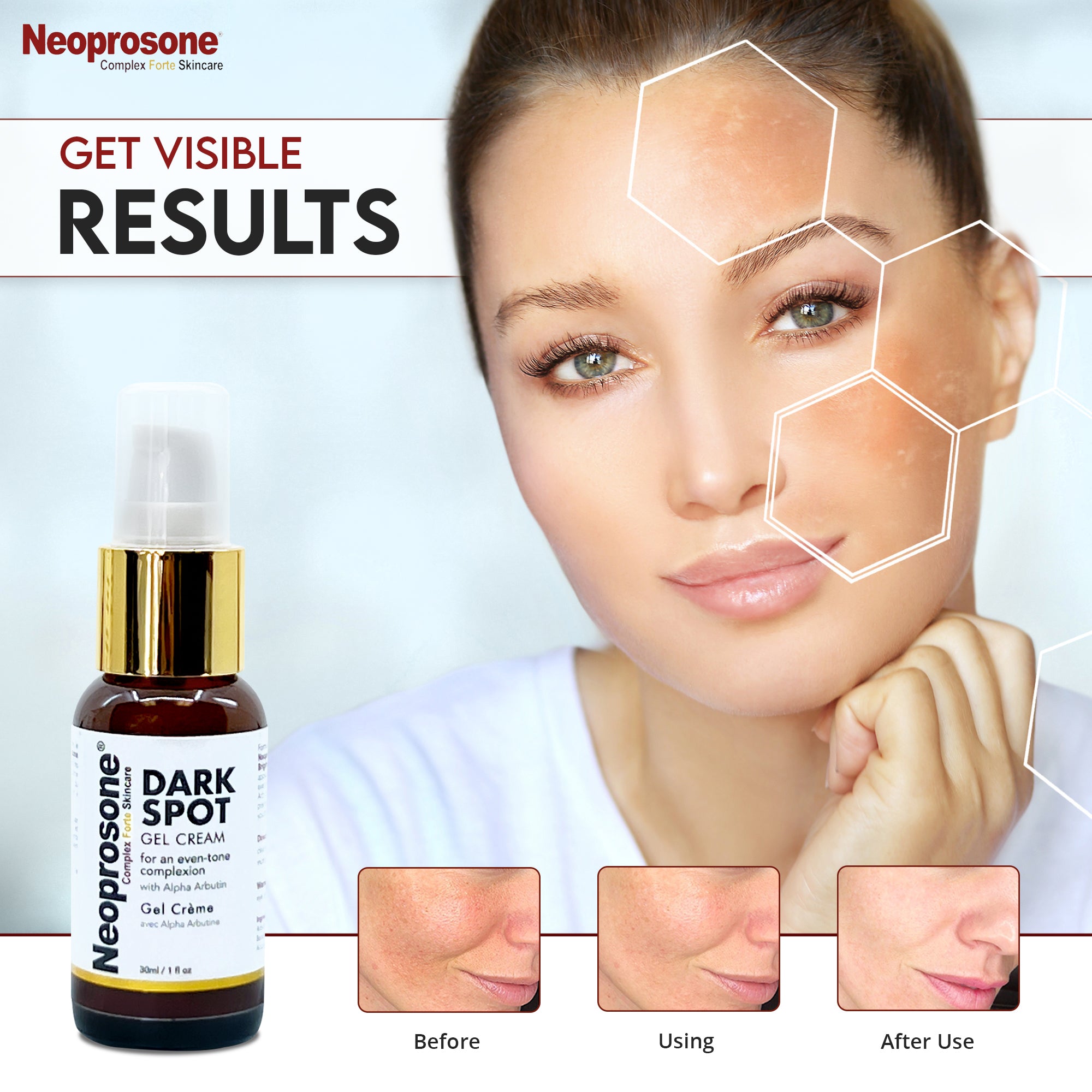 Neoprosone Dark Spot Remover Gel Cream 30ml (Pump)