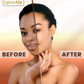 LightenUp Plus Lightening Body Lotion Result In 7 Days 400ml